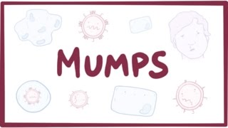 Mumps  symptoms diagnosis treatment pathology [upl. by Relyk694]