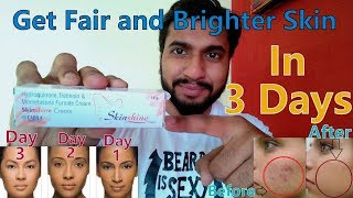 How To Get Fair Skin  Skin Shine Cream Review in Hindi  Remove Dark Spots  Hydroquinone 2 [upl. by Daahsar830]