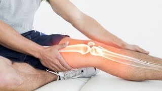 Esguince de rodilla  Rehabilitacion en casa [upl. by Clevey]