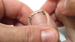 Tuto Comment bien se couper les ongles de pied pour éviter tout ongle incarné manière technique [upl. by Ettelra420]