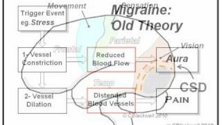 Migraine 1 The Experience [upl. by Akinet]