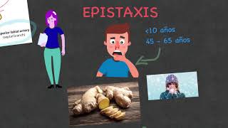 Epistaxis  Sangrado nasal Etiología diagnóstico y tratamiento [upl. by Rask]