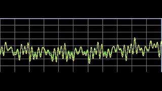 Nervous System Disorders  Rife Frequencies [upl. by Naoma]