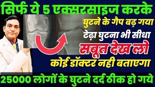 सिर्फ ये 5 एक्सरसाइज करके 25000 लोगों ने घुटने दर्द ठीक किया सबूत देख लो  Knee pain exercises [upl. by Venator]