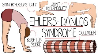 Ehlers Danlos Syndrome Explained Clearly [upl. by Afnin]