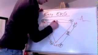 Easy EKG Einthovens Triangle [upl. by Ellahcim]