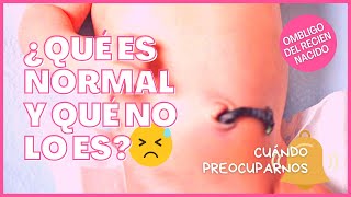 😵 Signos de ALARMA en el ombligo de un BEBÉ  ⚠️ ¿Cuándo consultar ¿Cómo cuidarlo 🔎 [upl. by Petras]