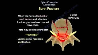 Low Back pain spine fractures thoracic disc herniation Waddell signs Trendelenburg gait [upl. by Allison]