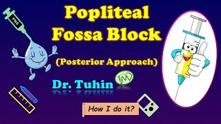 PNS guided Popliteal Sciatic Nerve Block  Intertendinous Approach  Popliteal Fossa Block [upl. by Yrod]