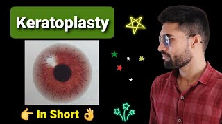 Keratoplasty lecture in opthalmology [upl. by Dittman539]