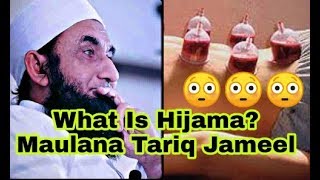 What Is Hijama Maulana Tariq Jameel Sahab [upl. by Anthiathia]