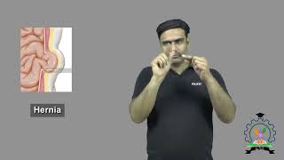 quotHerniaquot  Indian Sign Language Tutorial  How to Sign [upl. by Iruj]