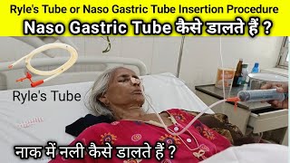 Ryles Tube or Naso gastric Tube insertion procedure Ryles Tube कैसे डालते हैं nasogastric Tube कैसे [upl. by Ikaz]