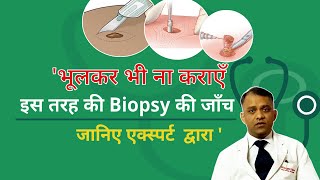 भूलकर भी ना कराएँ  इस तरह की Biopsy की जाँच  जानिए एक्स्पर्ट द्वारा [upl. by Agnesse]