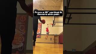 Fixing shin splits and increasing vertical jump [upl. by Ahserkal]