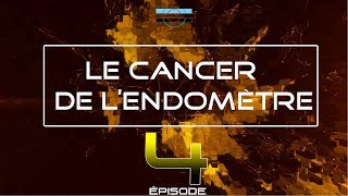 S4 Ep4 Le Cancer de lEndomètre [upl. by Alyt]