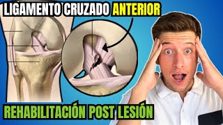 REHABILITACIÓN del Ligamento Cruzado Anterior LCA Sin CIRUGÍA con EJERCICIOS [upl. by Alleoj195]