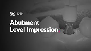 Abutment Level Impression [upl. by Marta]