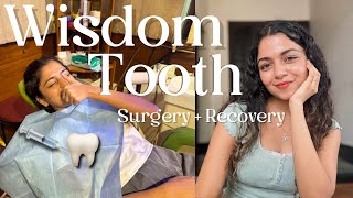 Wisdom tooth removal surgery  recovery and sharing my experience  Hansika Krishna [upl. by Mersey]