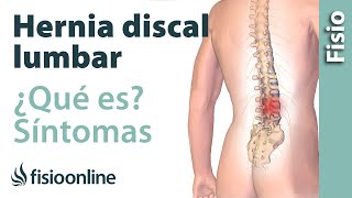 Hernia discal o de disco lumbar  Qué es causas síntomas y tratamiento [upl. by Huttan]