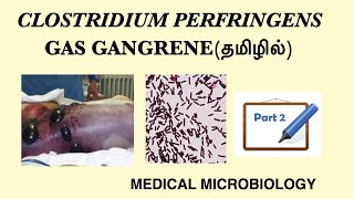 Clostridium perfringens Part 2  Gas gangrene  Pathogenesis  Lab diagnosis  Treatment  Tamil [upl. by Potash]