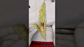 fish in bitter gourd need to surgery 🤯shorts fruitsurgery youtubeshorts [upl. by Gustafsson]