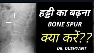 हड्डियों का बढ़ना क्या होता है Bone Spur and Osteophytes problems [upl. by Aihselef]