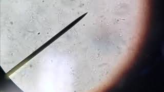 Bacillus Cereus Motility [upl. by Ylak]