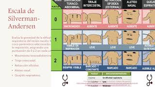 Escalas de valoración del recién nacido [upl. by Aenet]