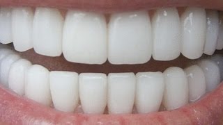 How To Have Natural White Teeth in 3 minutes  Works 100 [upl. by Gilbert]