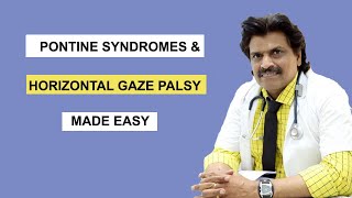 PONTINE SYNDROMES amp HORIZONTAL GAZE PALSY MADE EASY [upl. by Neall]