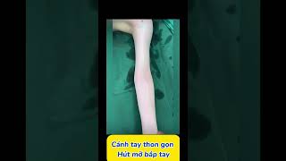 Liposuzione bicipite xuhuongyoutube lamdep thongthainguyen fyp [upl. by Cesare382]