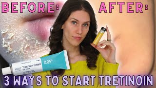 3 Ways To Start Tretinoin Without Irritation  How To Start Retinoids Without Irritation amp Peeling [upl. by Aissilem419]