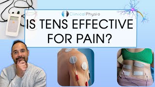 Does TENS Actually Work  Expert Physio Review [upl. by Raynah]