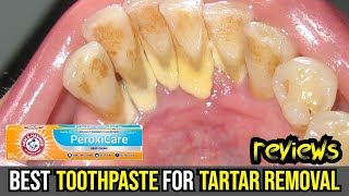 🦷✨ Revolutionize Your Smile Top 3 Tartar Removal Toothpastes Reviewed 🌟💫 [upl. by Ruperta]