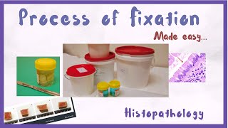 What is Fixation  Tissue Fixation in Histology  Hindi  Histopathology [upl. by Ahseele]