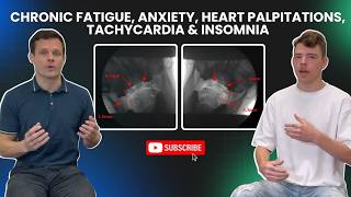 Chronic fatigue Anxiety Heart palpitations Tachycardia Insomnia  Upper Cervical Instability [upl. by Ahsotan793]