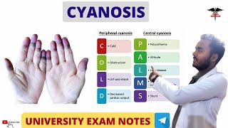 Cyanosis  Cyanosis Examination  Respiratory system physiology [upl. by Annaeirb]