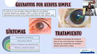 Principales patologías de la superficie ocular y cornea [upl. by Enayd]