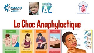 choc anaphylactique  part 1 [upl. by Yniatirb]