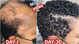 how I treat repair my damaged hair with one ingredient and here is my 30 day results [upl. by Atkinson]