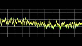 Herpes New 2  Rife Frequencies [upl. by Airdnas499]