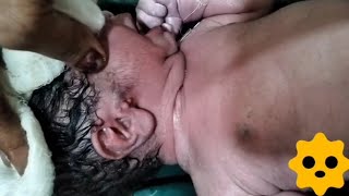 Abnormal Baby Clean Video After Birth😢😢 AfterBirth baby cute abnormalbaby rohitpathaknursing [upl. by Dann463]