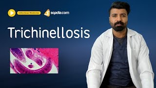 Trichinellosis  Infectious Disease Video Lectures  Medical Education  VLearning [upl. by Zysk]