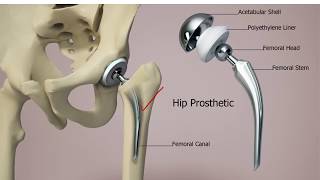 Orthopedics Instruments Video No 19 [upl. by Weasner]