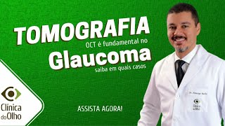 Glaucoma X OCT parte 2 [upl. by Reivaz58]