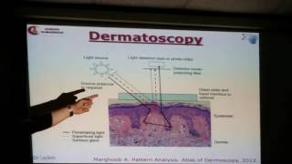 Dr Ahmed Sadek  Introduction to dermoscopy  Part 1 [upl. by Bear]