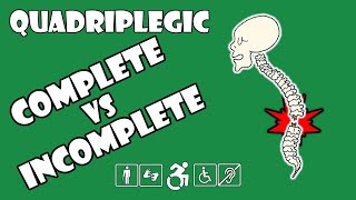 Complete vs Incomplete Spinal Cord Injury Explained  Quadriplegic C5C6C7 [upl. by Rentschler]