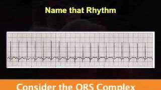 Introduction to EKG Rhythm Interpretation Part 2 [upl. by Nine]