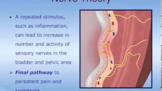 Understanding Interstitial Cystitis ICPainful Bladder Syndrome PBS [upl. by Adlih823]